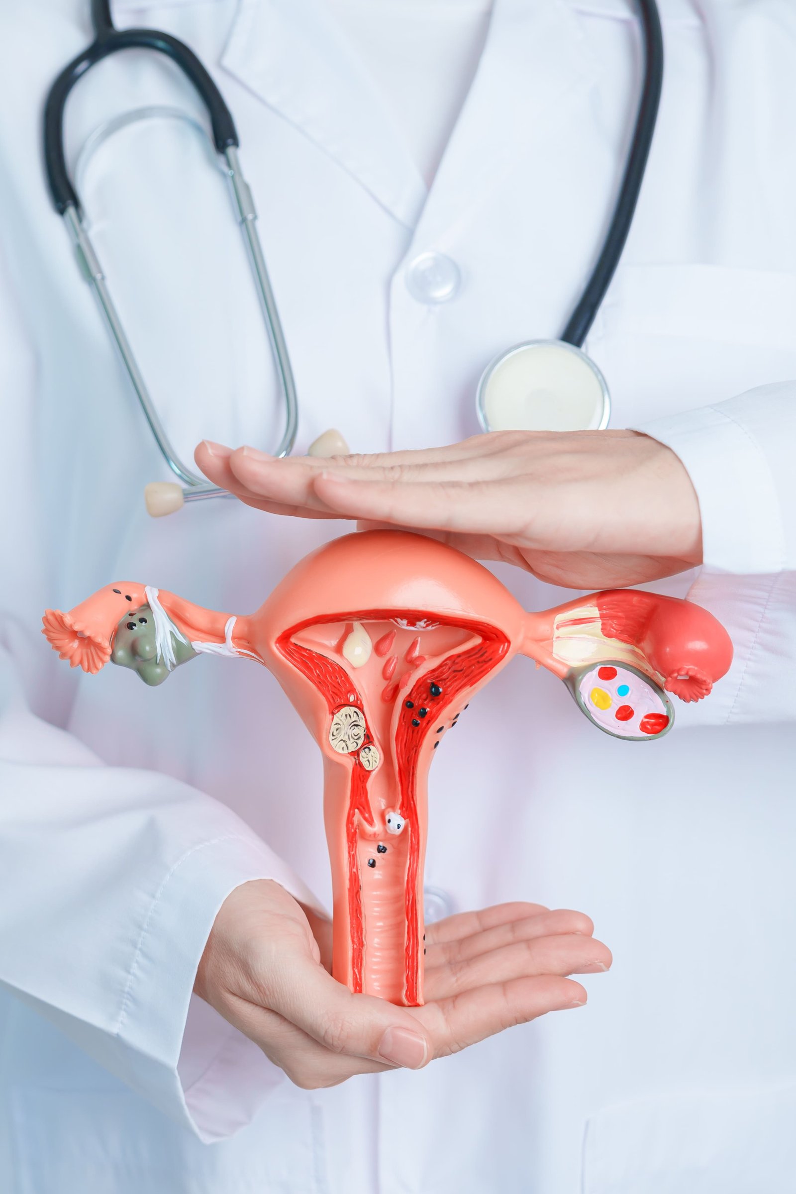 Gynecology